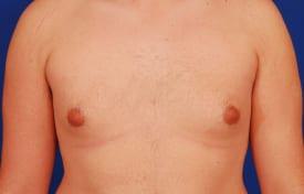 Patient Before & After Image