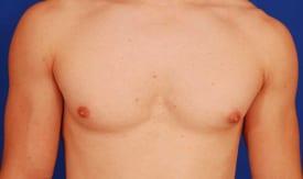 Patient Before & After Image