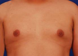 Patient Before & After Image