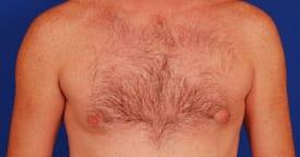 Patient Before & After Image