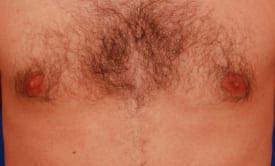 Patient Before & After Image