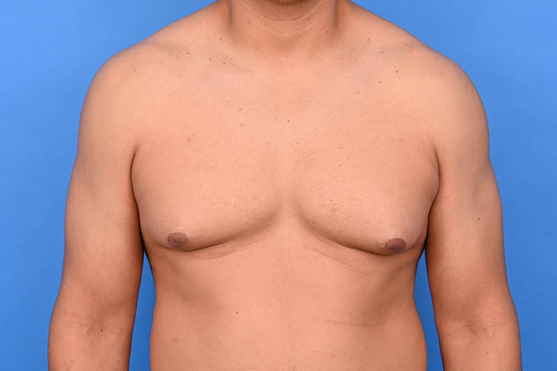 Patient Before & After Image