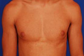 Patient Before & After Image