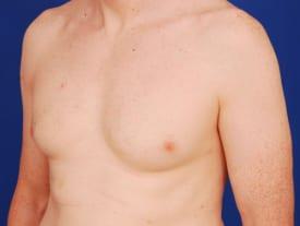 Patient Before & After Image