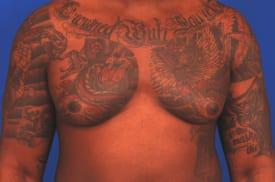 Patient Before & After Image