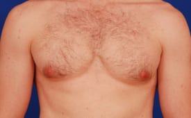 Patient Before & After Image