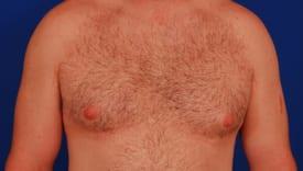 Patient Before & After Image