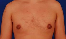 Patient Before & After Image