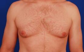 Patient Before & After Image