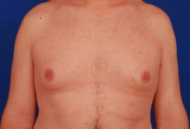 Patient Before & After Image