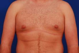 Patient Before & After Image