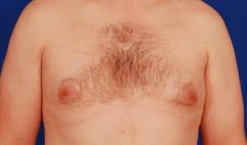 Patient Before & After Image