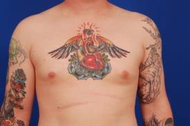 Patient Before & After Image