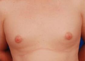 Patient Before & After Image