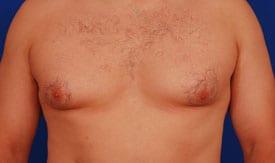 Patient Before & After Image