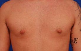 Patient Before & After Image