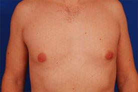 Patient Before & After Image