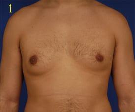 Patient Before & After Image