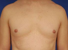 Patient Before & After Image