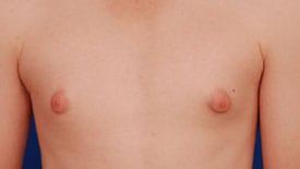 Patient Before & After Image