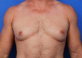 Patient Before & After Image