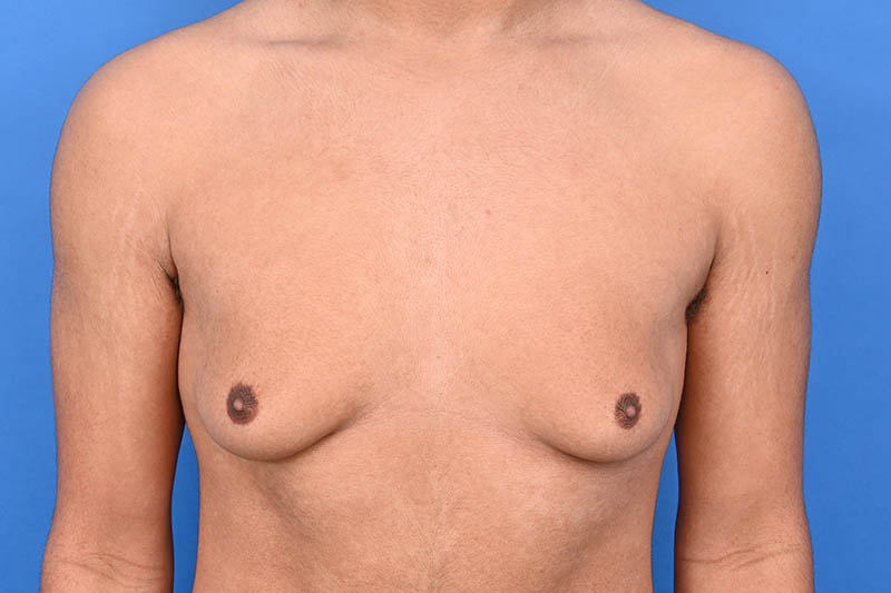 Patient Before & After Image