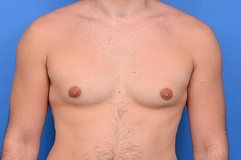 Patient Before & After Image