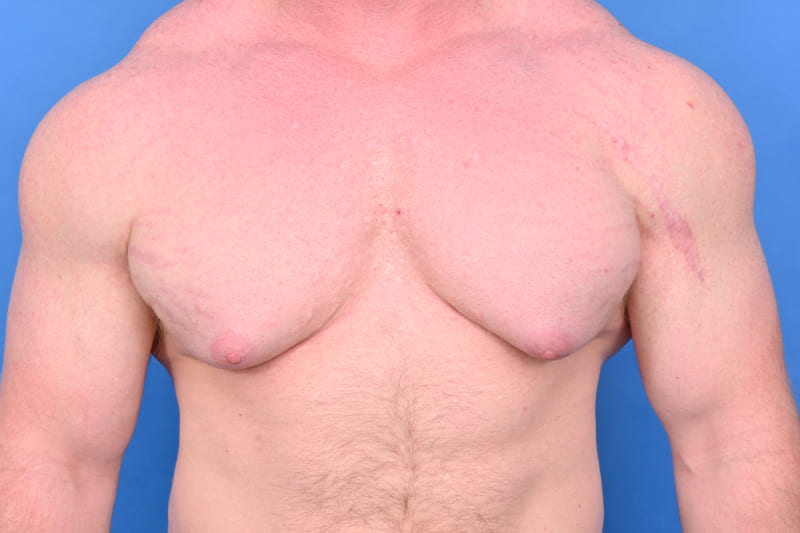 Patient Before & After Image