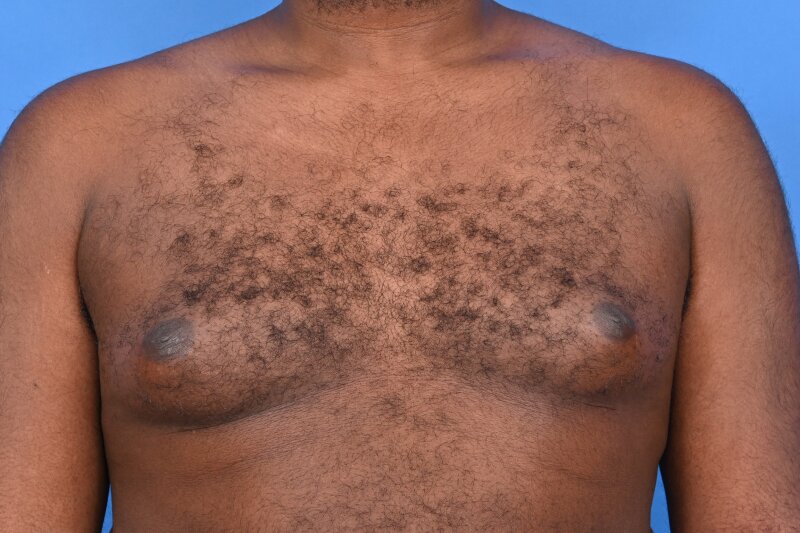 Patient Before & After Image