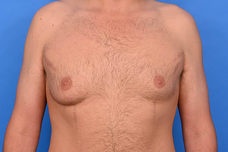 Patient Before & After Image