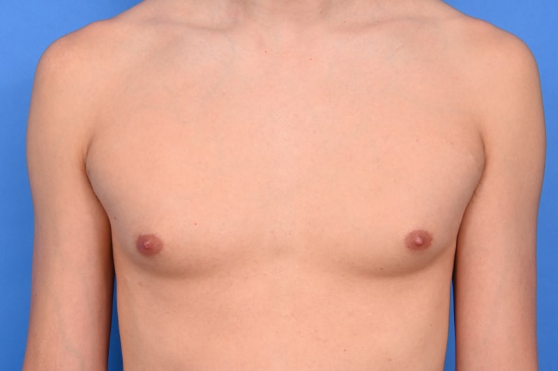 Patient Before & After Image