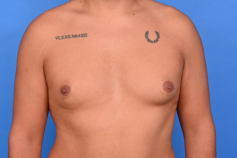 Patient Before & After Image