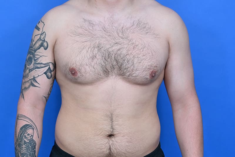 Patient Before & After Image