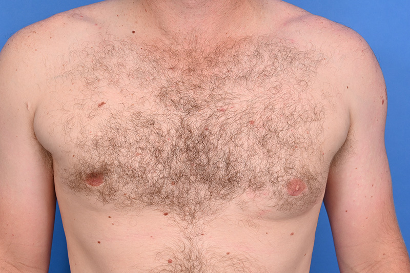 Patient Before & After Image