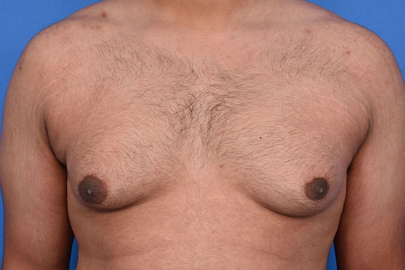 Patient Before & After Image