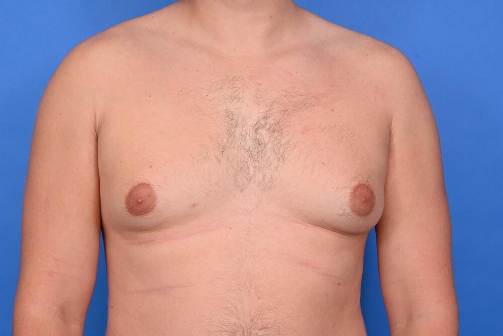 Patient Before & After Image