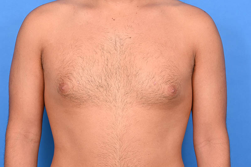 Patient Before & After Image