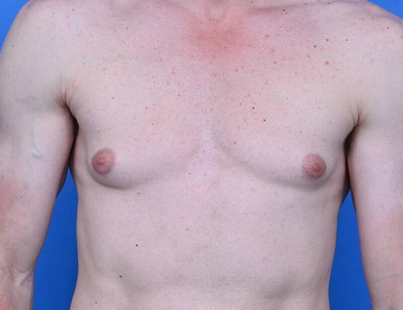 Patient Before & After Image