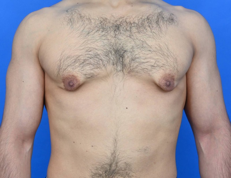 Patient Before & After Image