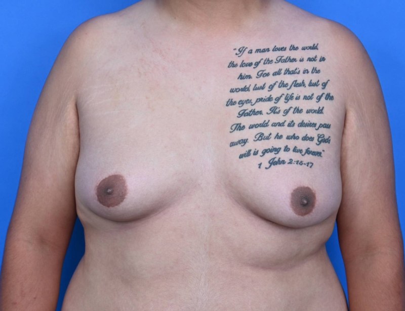 Patient Before & After Image