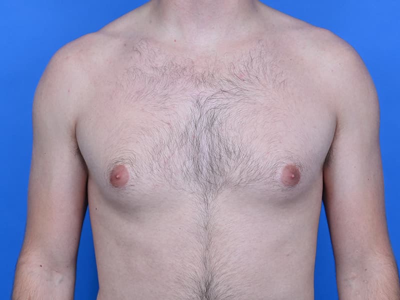 Patient Before & After Image