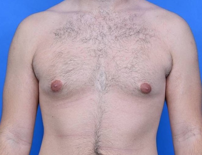 Patient Before & After Image