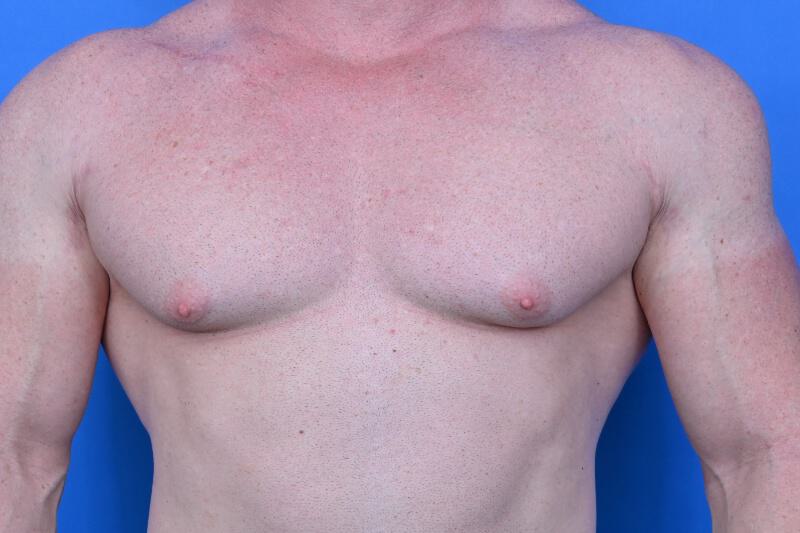 Patient Before & After Image