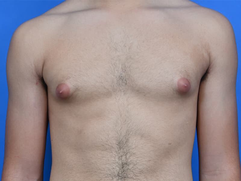 Patient Before & After Image