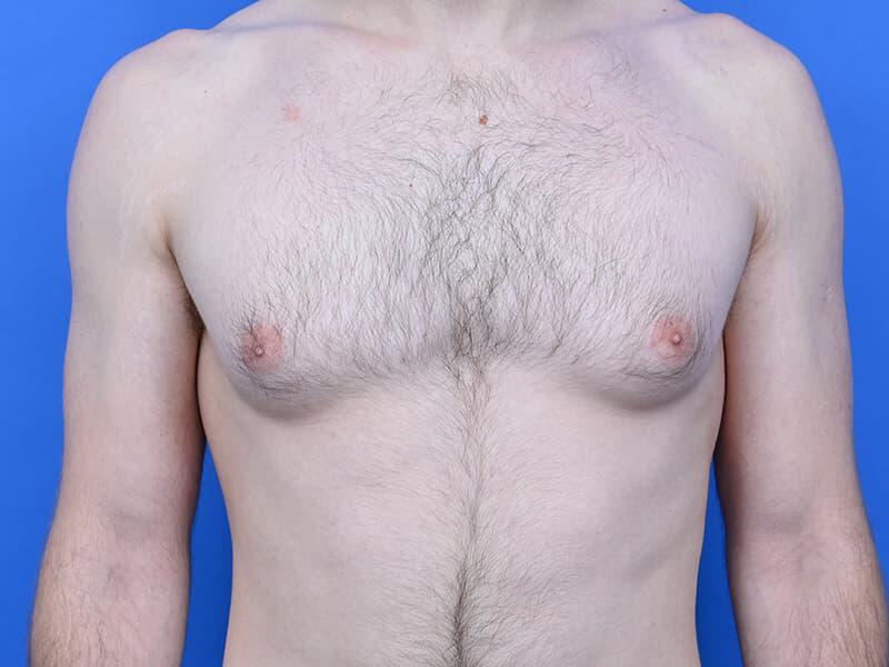 Patient Before & After Image