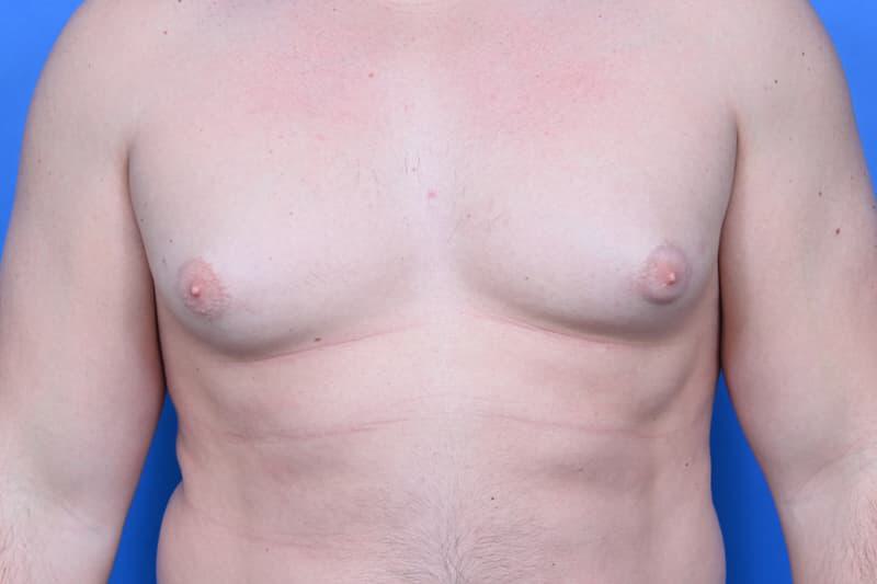 Patient Before & After Image