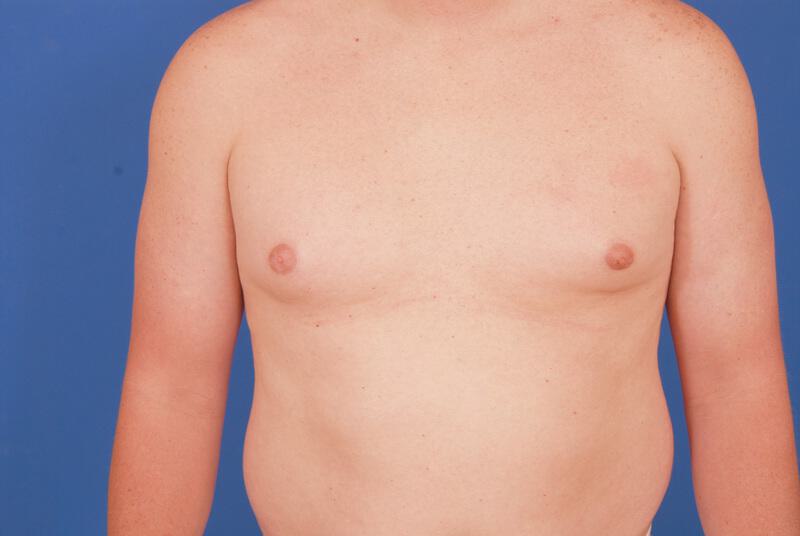 Patient Before & After Image