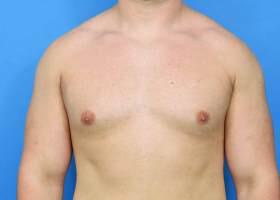 Patient Before & After Image