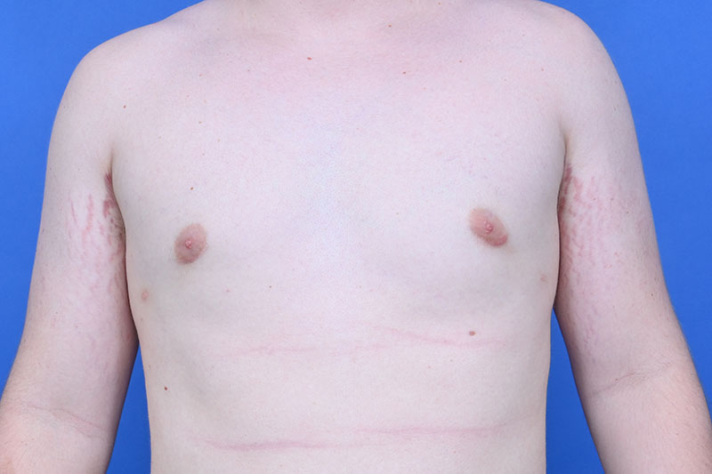 Patient Before & After Image