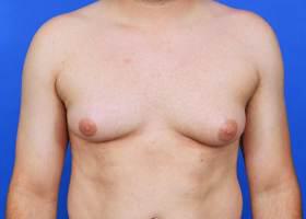 Patient Before & After Image